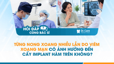 [HỎI ĐÁP BÁC SĨ]: Từng nong xoang nhiều lần do viêm xoang mạn có ảnh hưởng đến cấy Implant hàm trên không?