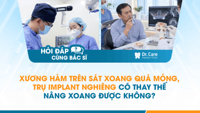 [HỎI ĐÁP BÁC SĨ]: Xương hàm trên sát xoang quá mỏng, trụ Implant nghiêng có thay thế nâng xoang được không?