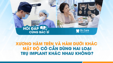 [HỎI ĐÁP BÁC SĨ]: Xương hàm trên và hàm dưới khác mật độ có cần dùng hai loại trụ Implant khác nhau không?