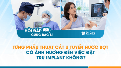 [HỎI ĐÁP BÁC SĨ]: Từng phẫu thuật cắt u tuyến nước bọt có ảnh hưởng đến việc đặt trụ Implant không?