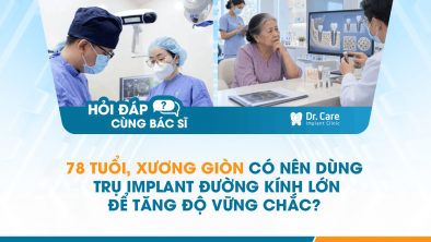 [HỎI ĐÁP BÁC SĨ]: 78 tuổi, xương giòn có nên dùng trụ Implant đường kính lớn để tăng độ vững chắc?