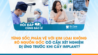 [HỎI ĐÁP BÁC SĨ]: Từng sốc phản vệ với kim loại không rõ nguồn gốc có cần xét nghiệm dị ứng trước khi cấy Implant?