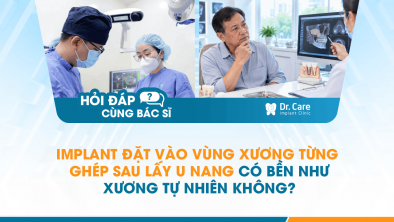 [HỎI ĐÁP BÁC SĨ]: Implant đặt vào vùng xương từng ghép sau lấy u nang có bền như xương tự nhiên không?