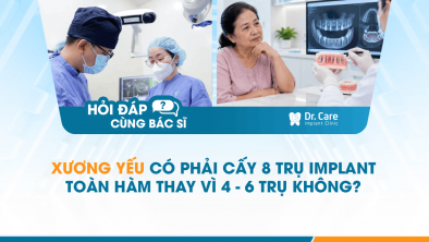 [HỎI ĐÁP BÁC SĨ]: Xương yếu có phải cấy 8 trụ Implant toàn hàm thay vì 4–6 trụ không?