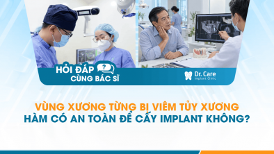 [HỎI ĐÁP BÁC SĨ]: Vùng xương từng bị viêm tủy xương hàm có an toàn để cấy Implant không?