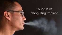 Tác hại của thuốc lá đối với phương pháp trồng răng Implant (cấy ghép Implant)
