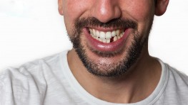 Trồng răng Implant thay thế 1 răng