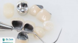 Tư vấn giá trồng răng sứ kim loại bằng cấy ghép Implant (trồng răng Implant)