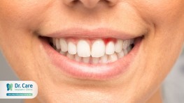 Nhận biết dấu hiệu viêm nướu răng sớm và cách phòng ngừa