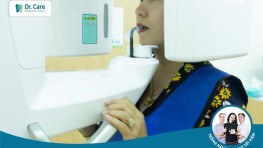 Dr. Care hỗ trợ gói khám, tư vấn trồng răng Implant trị giá 3.420.000 VNĐ