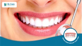 [Giải đáp] Sau khi mài răng bọc sứ nên kiêng gì?