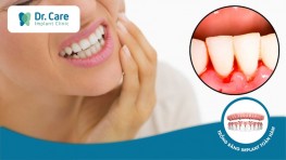Chảy máu chân răng: Nguyên nhân và cách điều trị vĩnh viễn