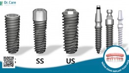 Trồng răng Implant có gây dị ứng không?