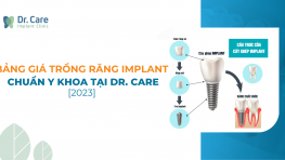 Bảng giá trồng răng Implant chuẩn y khoa tại Dr. Care [2023]