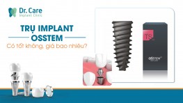 Trụ Implant Osstem - Tìm hiểu xuất xứ, ưu điểm và giá cả