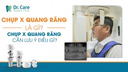 Chụp X quang răng là gì? Chụp X quang răng cần lưu ý điều gì?