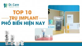 Top 10 dòng trụ Implant phổ biến nhất hiện nay