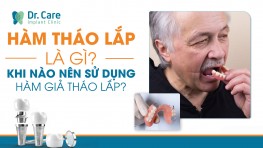 Hàm tháo lắp là gì? Khi nào nên sử dụng hàm giả tháo lắp?