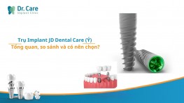 Trụ Implant JD Dental Care (Ý) – Tổng quan, so sánh và có nên lựa chọn khi trồng răng Implant ?