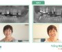 Trồng răng Implant chẳng đau như cô Trúc nghĩ