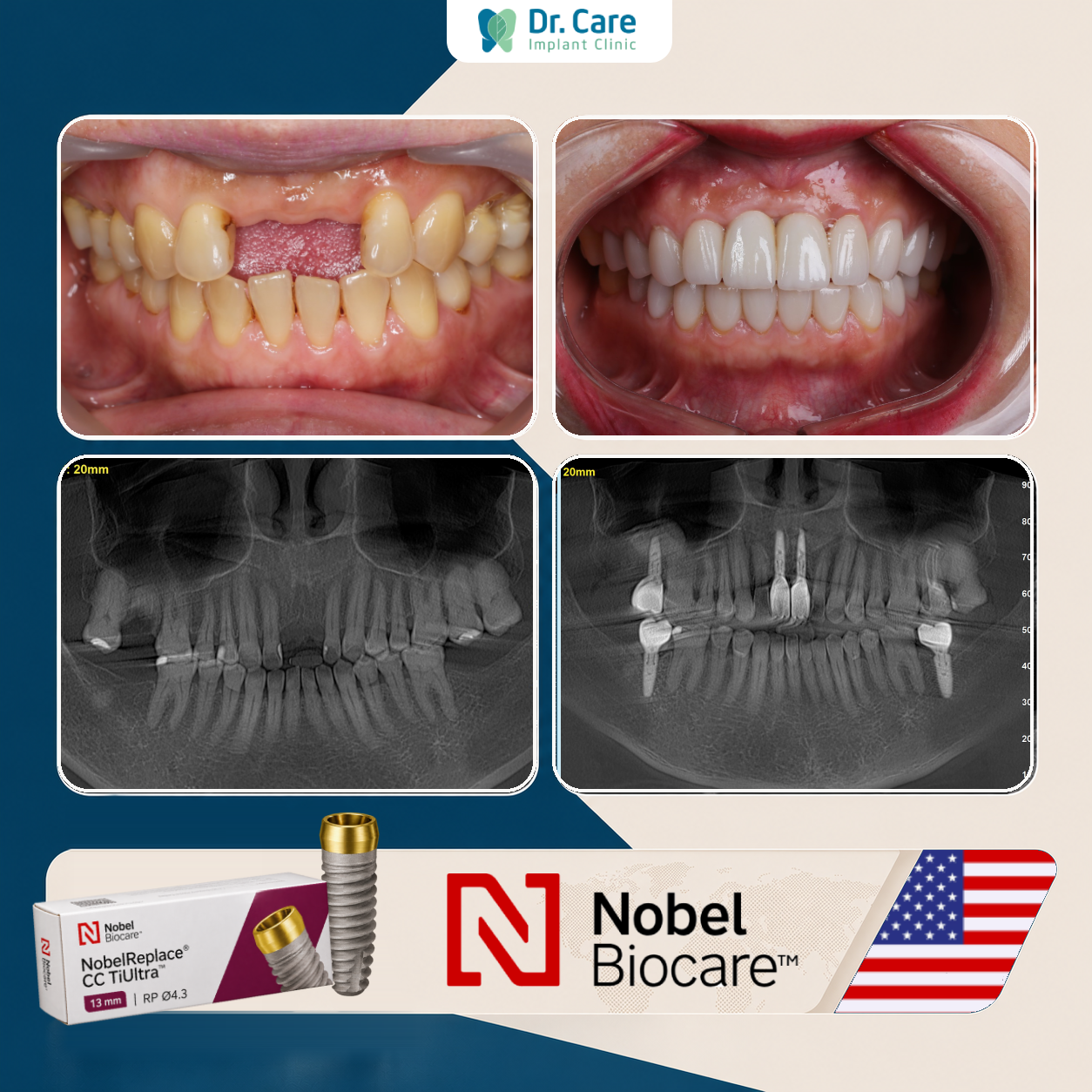 DR CARE