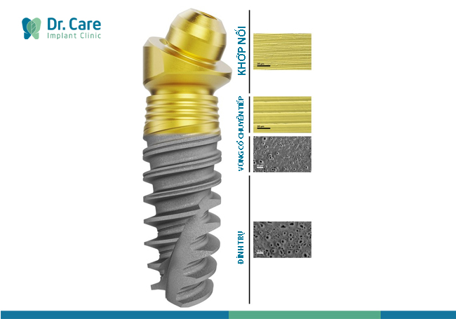 trụ implant nobel biocare