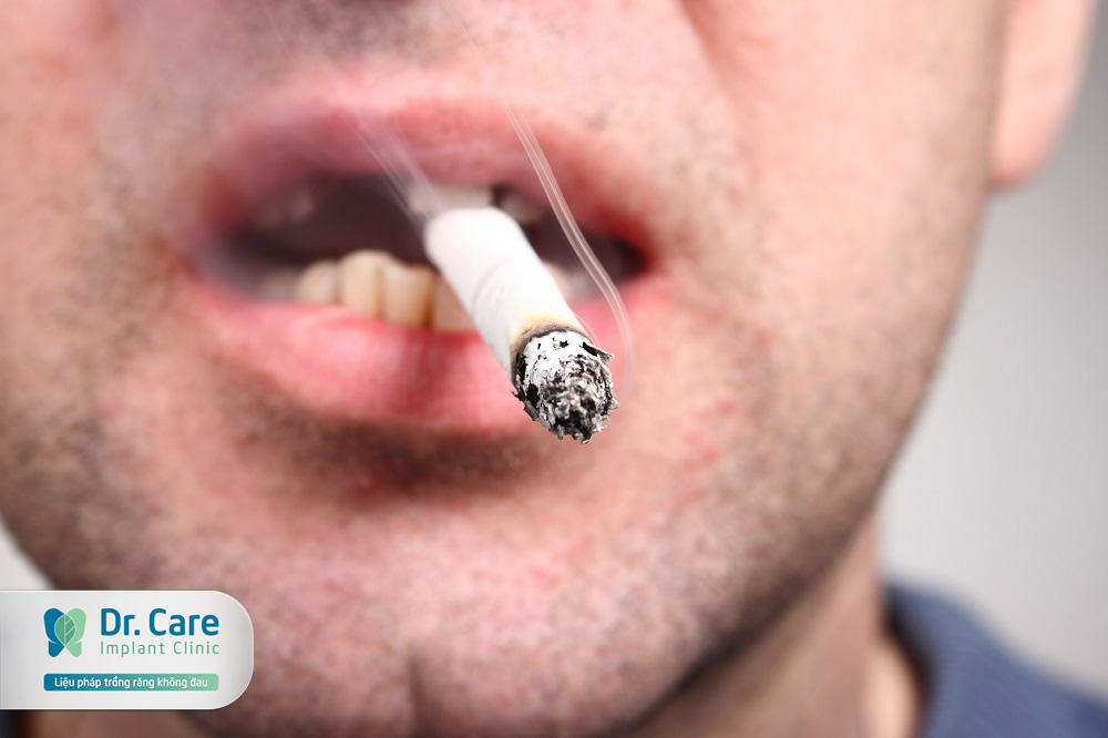 Răng giả bị sâu: Nguyên nhân và cách phục hình răng tốt nhất