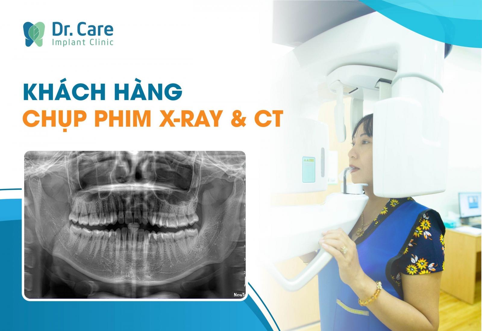 BƯỚC 3: MỜI KHÁCH HÀNG CHỤP PHIM CT 3D